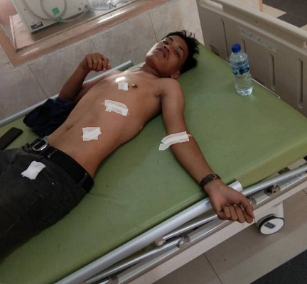 PAP Ditikam Oknum Pengamen di Jalan Adam Malik